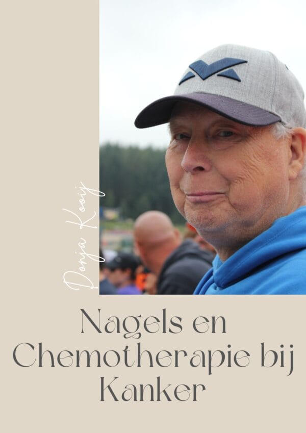 E-Book Nagels en Chemotherapie: Zorg en Herstel tijdens Behandeling